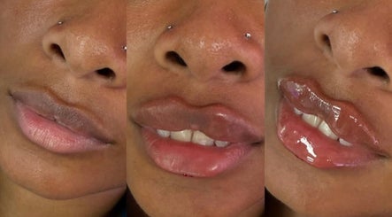 Lips transformation showcasing before and after lip care service at Honeys Beauty Galore, London, England, GB.