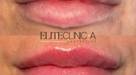 Elite Clinic A billede 3