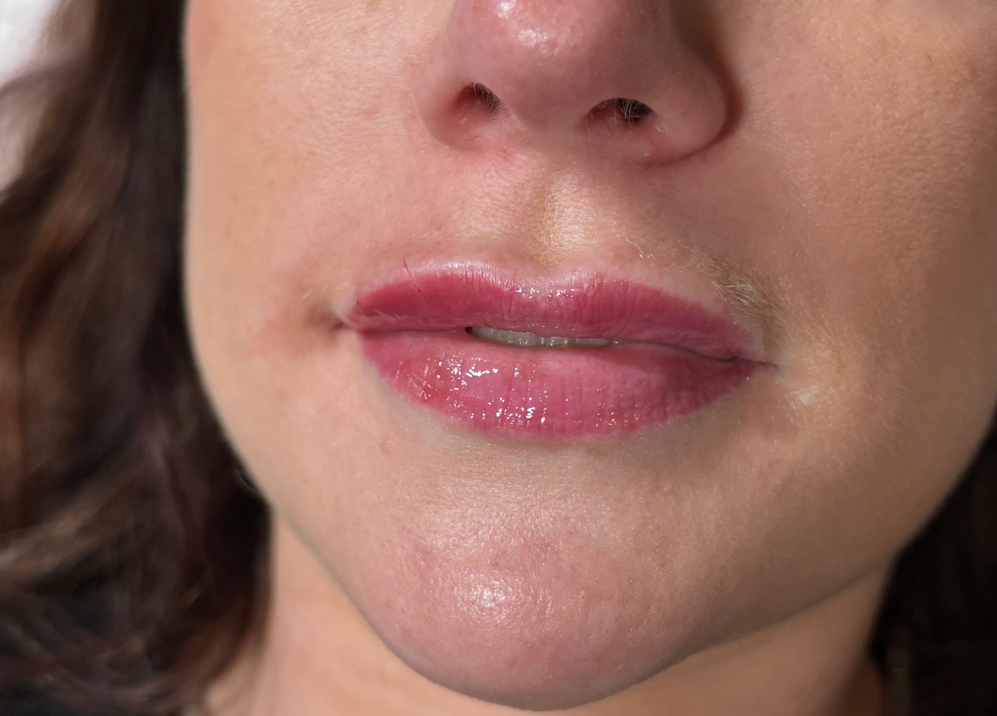Close-up of lips with gloss at Serene Essence Aesthetics in Edinburgh, Scotland, GB.
