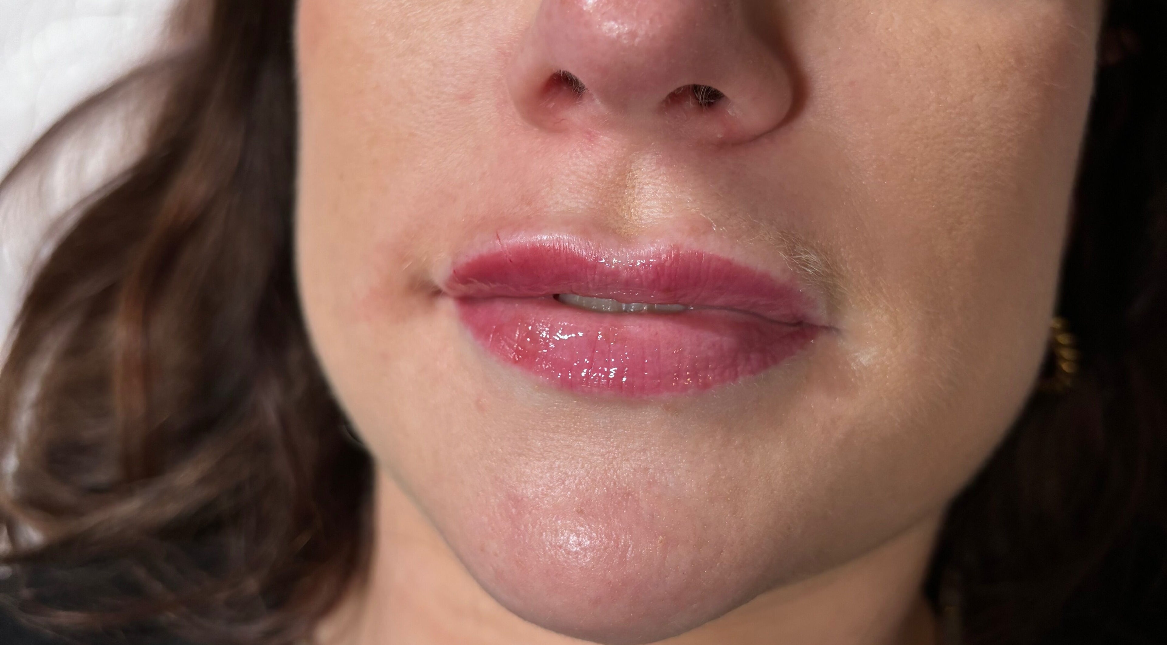 Close-up of lips with gloss at Serene Essence Aesthetics in Edinburgh, Scotland, GB.