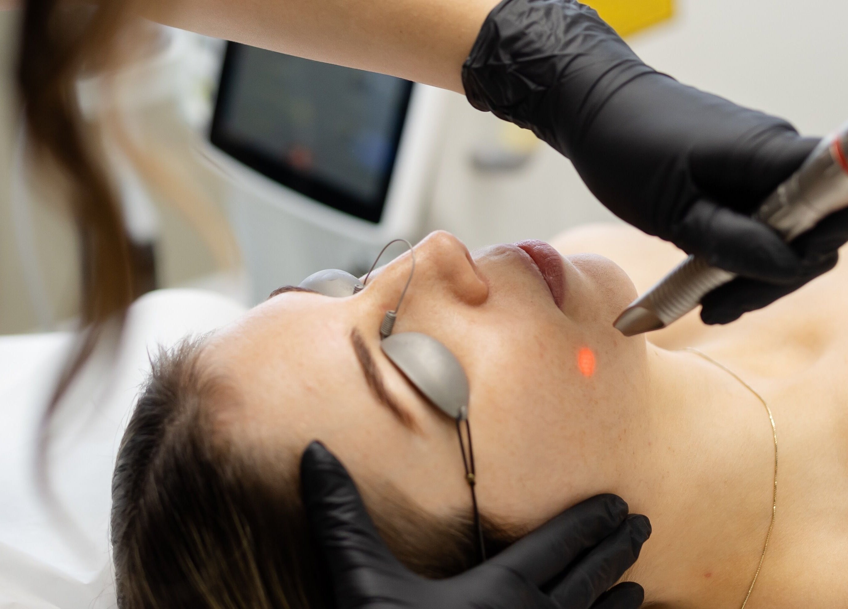 Facial laser treatment at The Babe Cave, Hanover, Ontario, CA, enhancing skin rejuvenation and radiance.