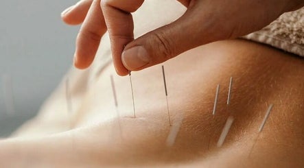 Ellen Coleman Acupuncturist image 3