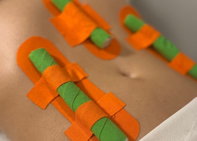 Advanced body wrap therapy at BCM.AESTHETICS, London, England, GB offers rejuvenating wellness experience.