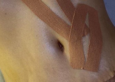 Therapeutic tape applied on abdomen at BCM.AESTHETICS, London, England, GB for wellness benefits.