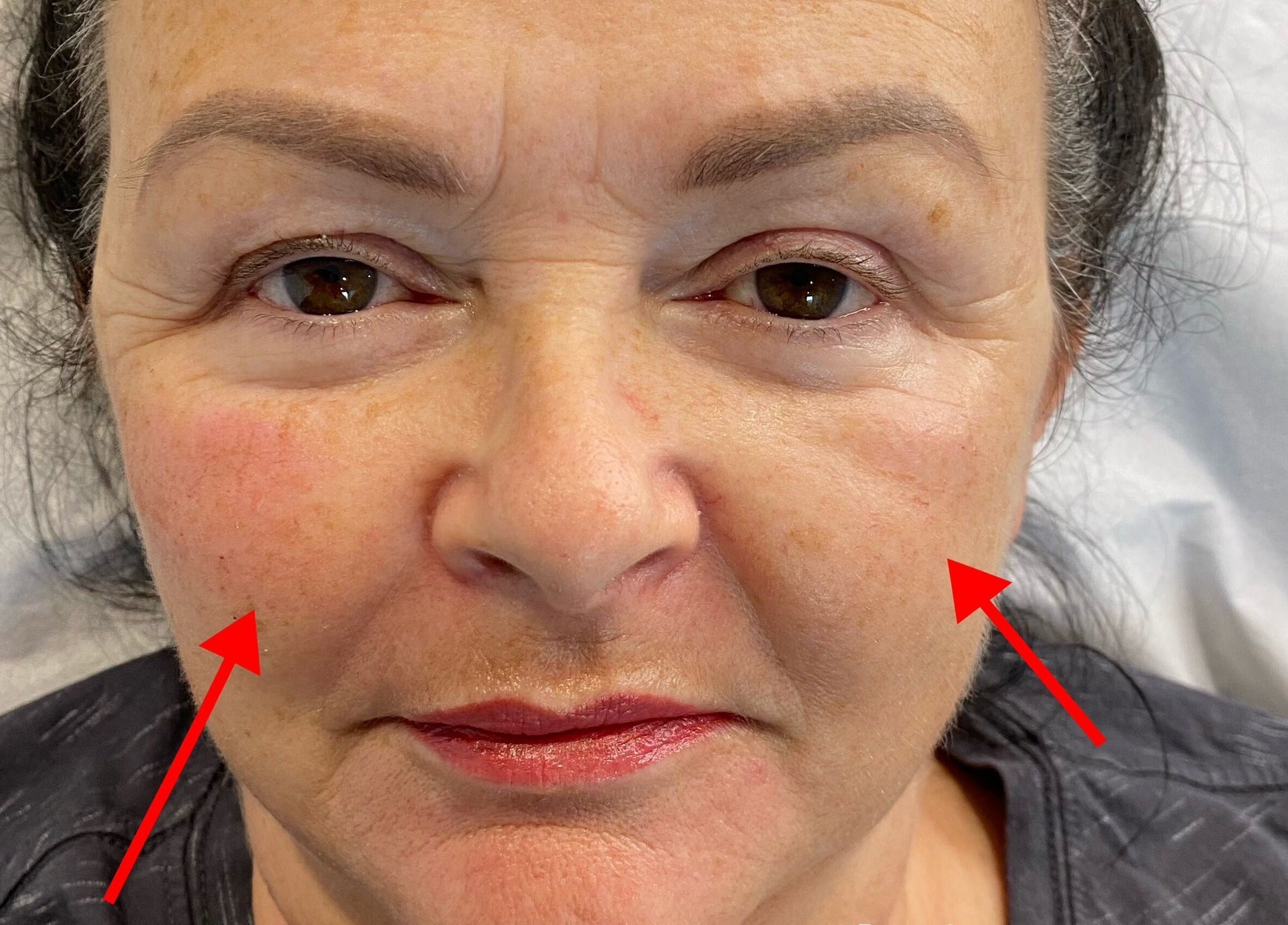 Treatment area at Beauty Box SPMU & Aesthetics Anna Tempska, Bingham, England, GB. Facial aesthetics close-up.