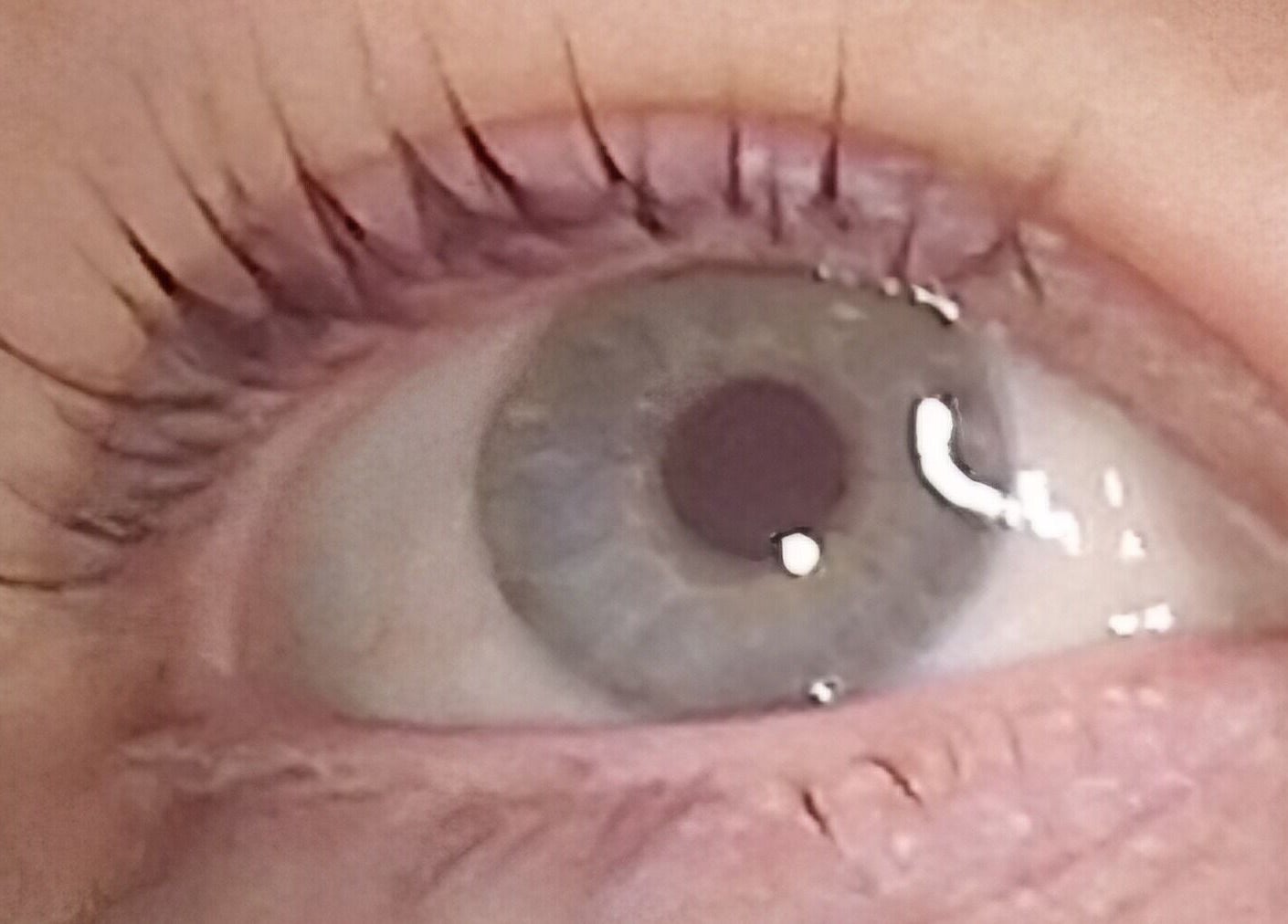 Close-up of an eye showcasing treatments at Lisa Luxe Treatments, Blackwell, England, GB.