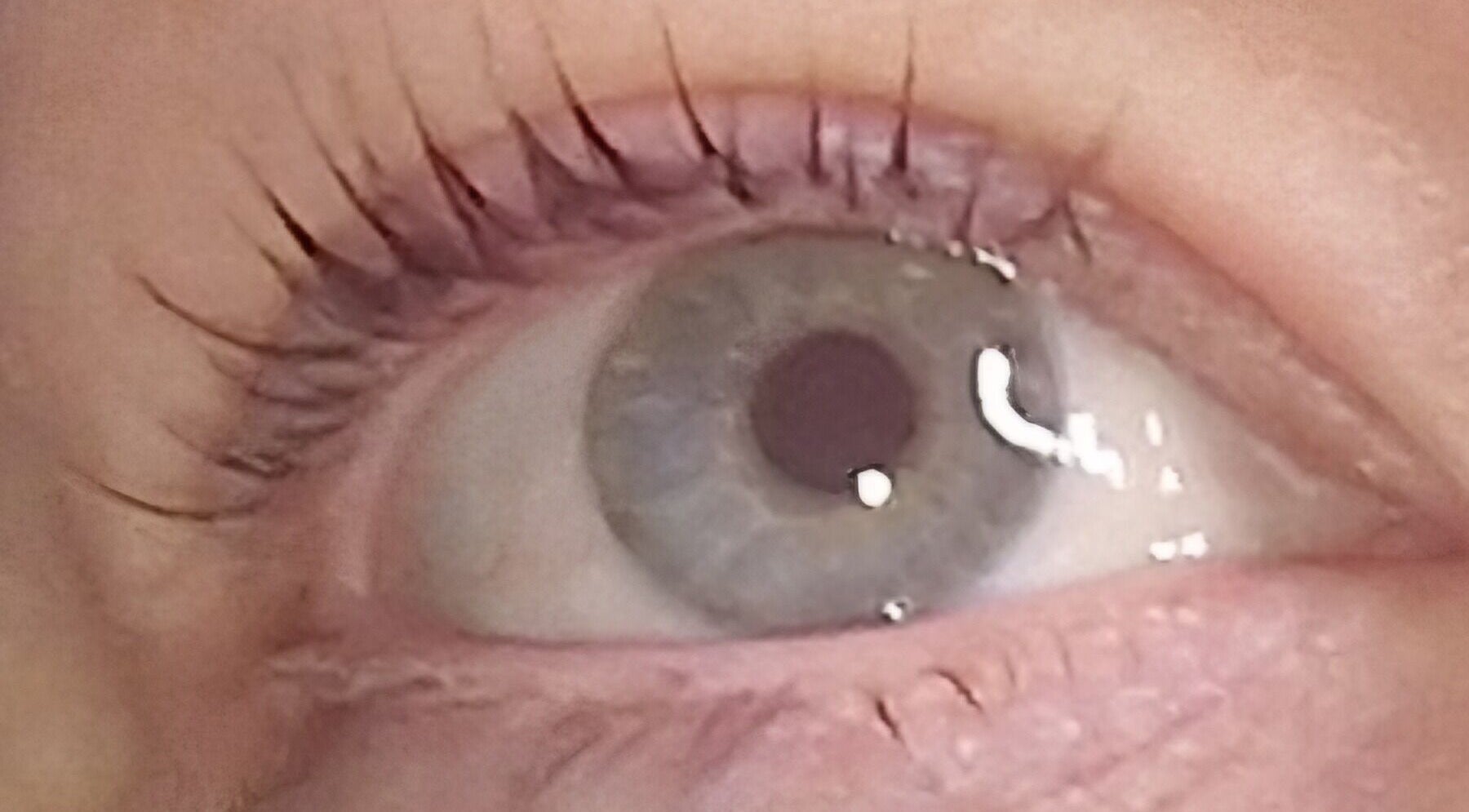 Close-up of an eye showcasing treatments at Lisa Luxe Treatments, Blackwell, England, GB.
