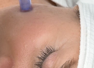 Facial en Nanda Skin - Surco, Santiago De Surco, Provincia De Lima, PE. Mejora la piel y rejuvenece el rostro.