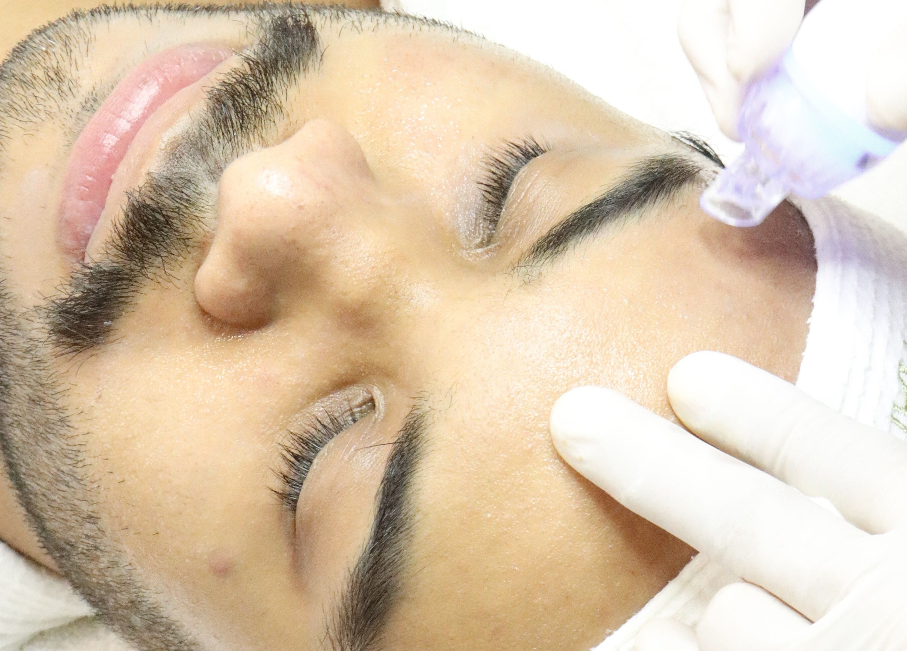 Tratamiento facial en Nanda Skin - Miraflores, Lima, Provincia De Lima, PE usando tecnología avanzada.