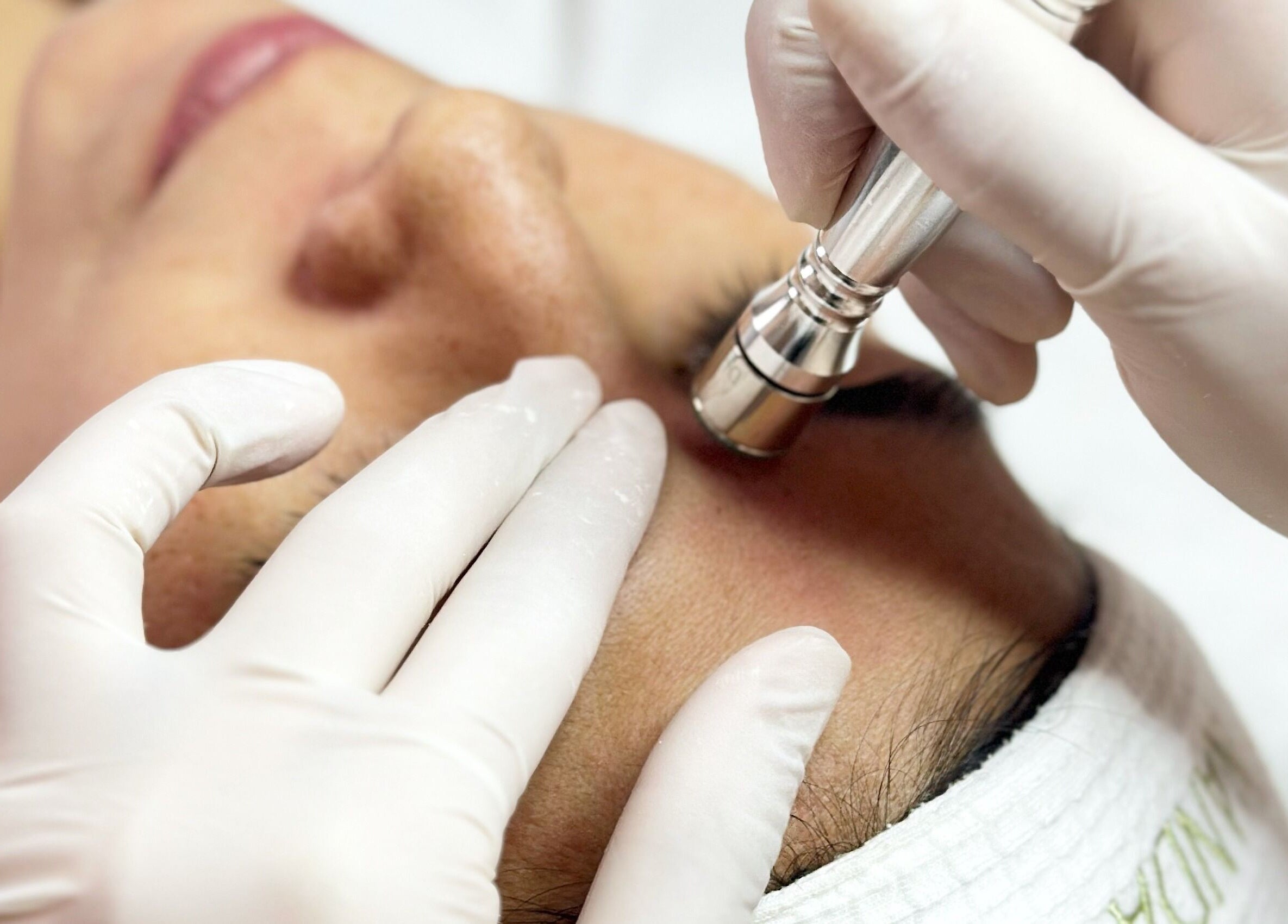 Tratamiento facial en Nanda Skin - Miraflores, Lima, Provincia De Lima, PE, mostrando microdermoabrasión.