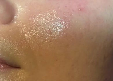 Close-up of glowing skin treatment at Look Like A Million Dollars, London, England, GB.