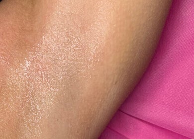 Close-up of a moisturized arm at Ep Laser Clinic Shrewsbury in Shrewsbury, England, GB.