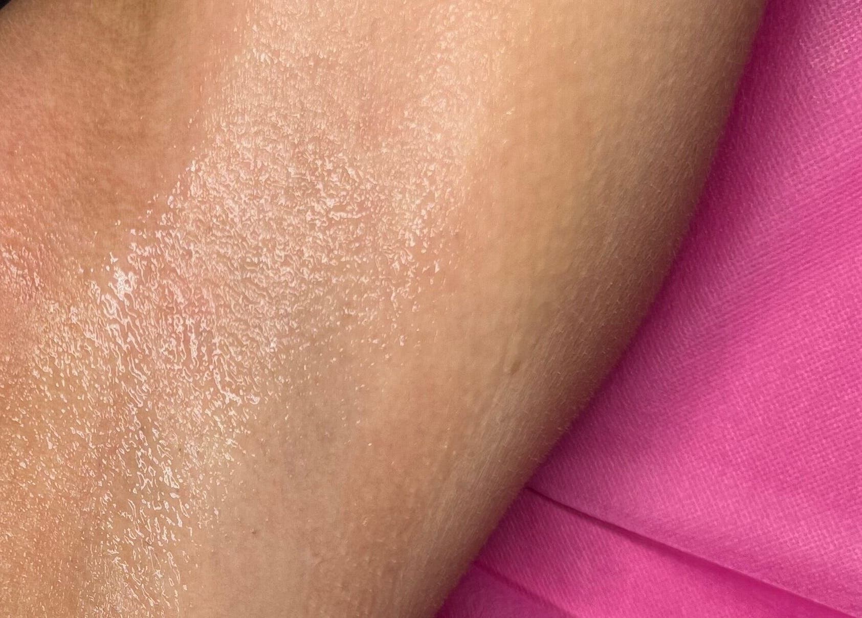 Smooth, treated skin at Ep Laser Clinic Shrewsbury, Shrewsbury, England, GB on a vibrant pink background.