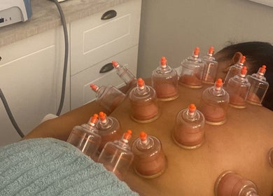 Tratamento de ventosaterapia no AnaMar Beauty, Gold Coast, Queensland, AU, promovendo relaxamento.
