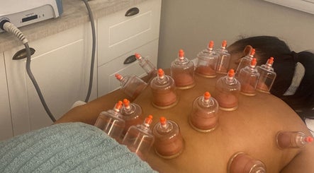 Tratamento de ventosaterapia no AnaMar Beauty, Gold Coast, Queensland, AU, promovendo relaxamento.