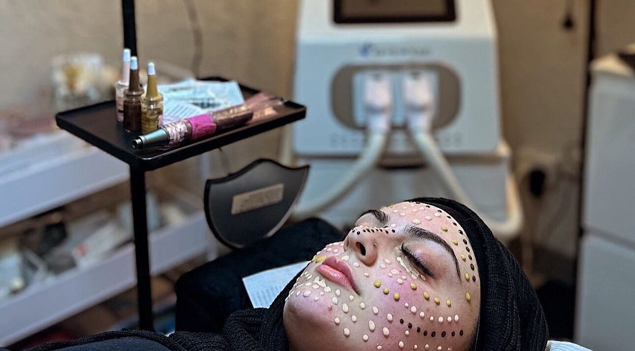 Client receiving facial treatment at Dermal Glowz, Punchbowl, New South Wales, AU with skincare equipment.
