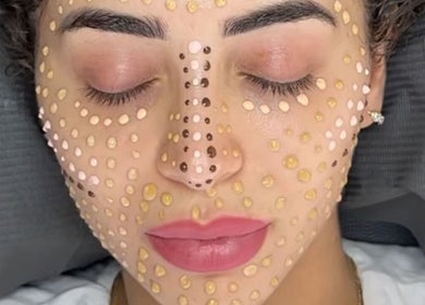 Facial treatment with beauty dots at Dermal Glowz, Punchbowl, New South Wales, AU.