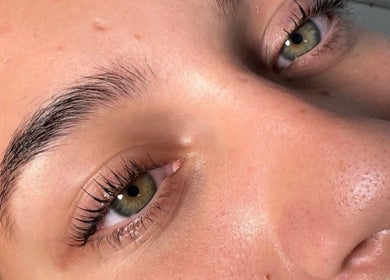 Close-up of a radiant skin treatment at The Derma Clinic Cheshire, Hyde, England, GB.