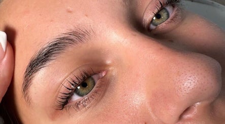 Close-up of a radiant skin treatment at The Derma Clinic Cheshire, Hyde, England, GB.
