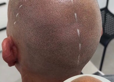 Micropigmentation capillaire à Soum SMP, El Achour, Algiers Province, DZ, offrant une finition soignée et précise.