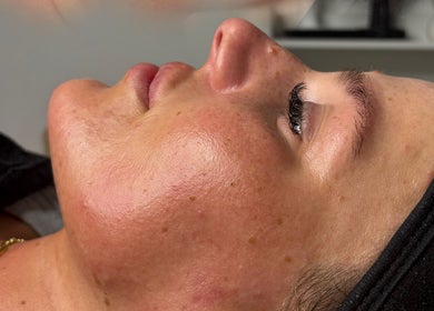 Close-up of a serene face enjoying a facial at Ethereal Beauty Lounge in Peterborough, England, GB.