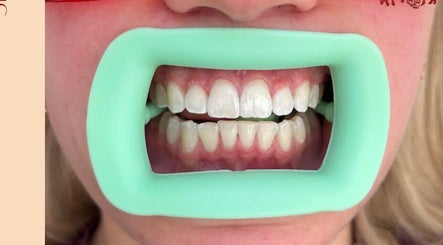 Kissed my Teeth