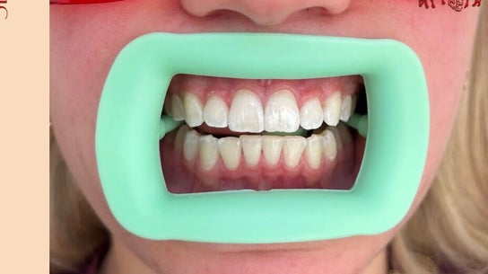 Kissed my Teeth