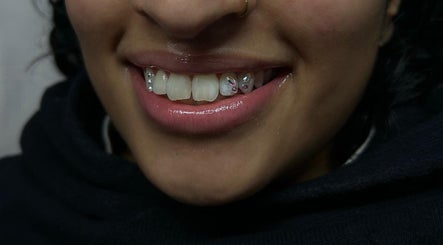Kissed my Teeth image 3