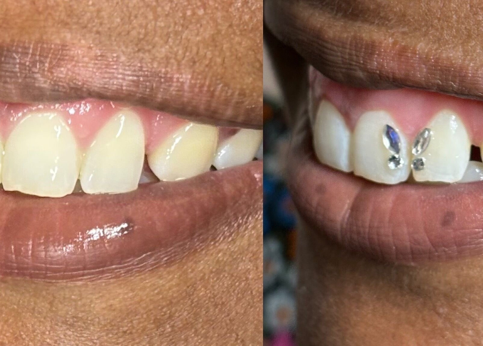 Tooth gems sparkle at Enchanted Beauty Haven, Muncie, Indiana, US, showcasing unique smile enhancements.