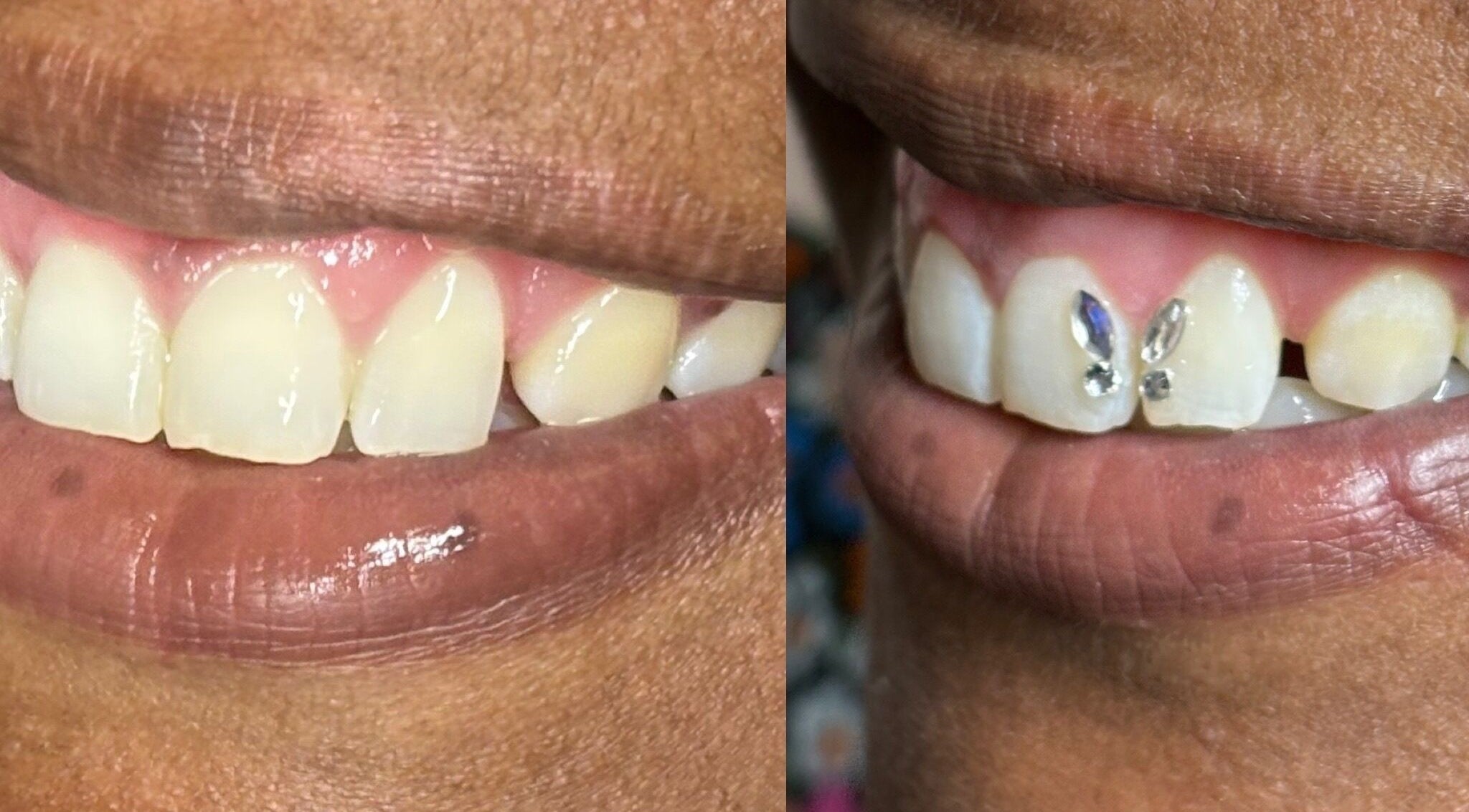 Tooth gems sparkle at Enchanted Beauty Haven, Muncie, Indiana, US, showcasing unique smile enhancements.