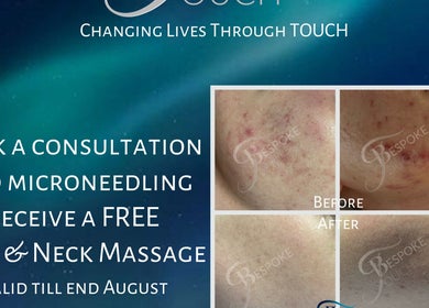 Bespoke Touch special offer in Centurion, Gauteng, ZA. Consultation, microneedling, and free massage included.