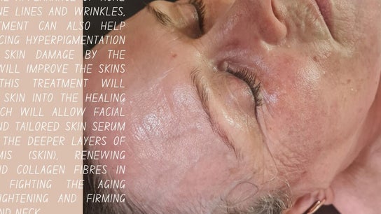 GS Beauty & Aesthetics - Mobile Only Local to NG4