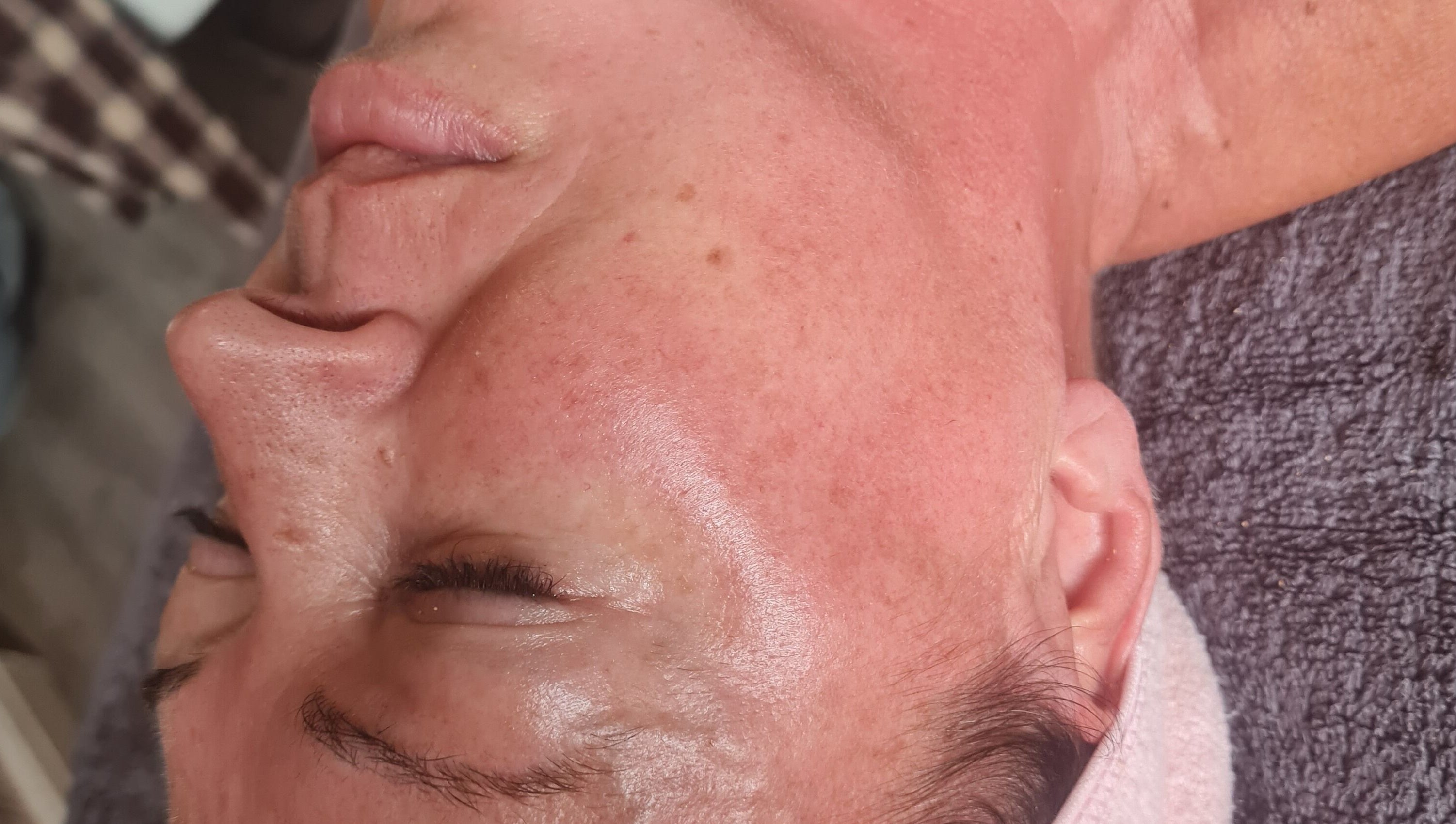 Facial treatment at GS Beauty & Aesthetics - Mobile Only Local to NG4, Netherfield, England, GB showcasing glowing skin.