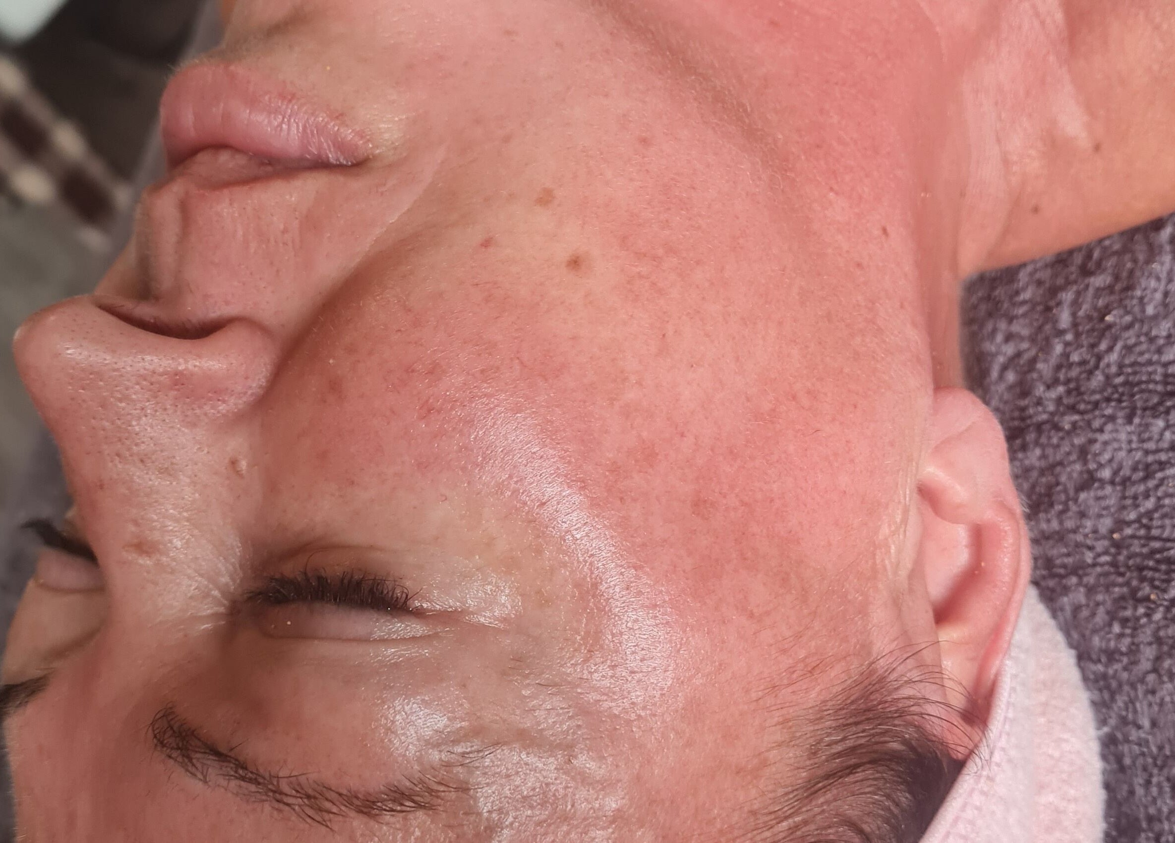 Facial treatment at GS Beauty & Aesthetics - Mobile Only Local to NG4, Netherfield, England, GB showcasing glowing skin.