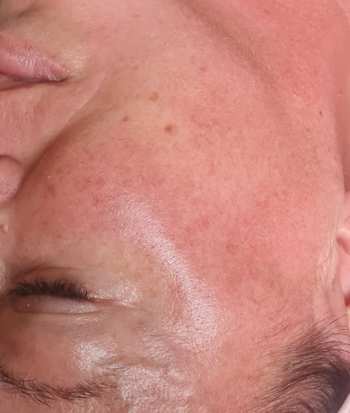 Facial treatment at GS Beauty & Aesthetics - Mobile Only Local to NG4, Netherfield, England, GB showcasing glowing skin.