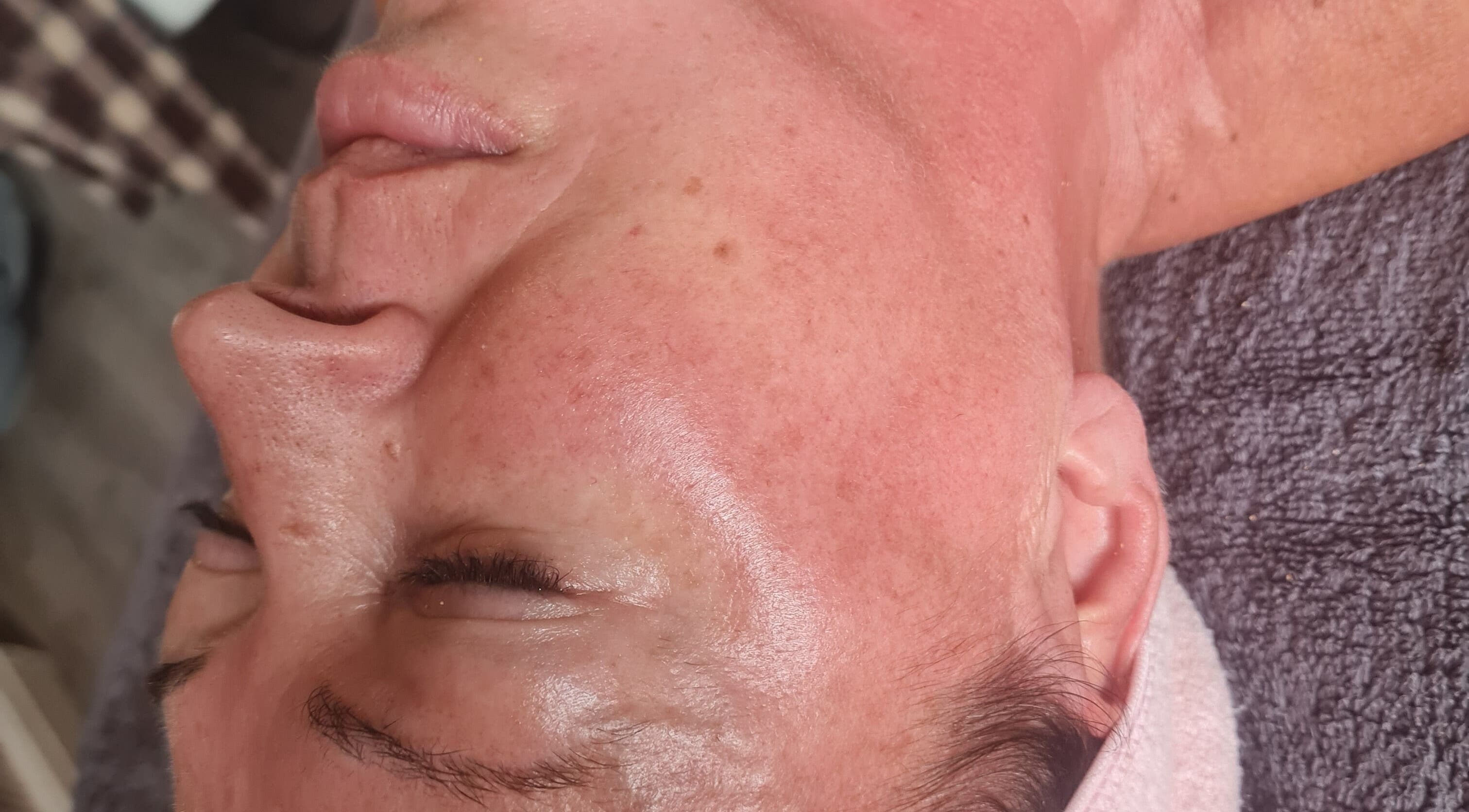 Facial treatment at GS Beauty & Aesthetics - Mobile Only Local to NG4, Netherfield, England, GB showcasing glowing skin.