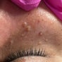Pure Aesthetics and Skin Care - calle lourdes B 3 segundo piso, local 3, Trujillo Alto