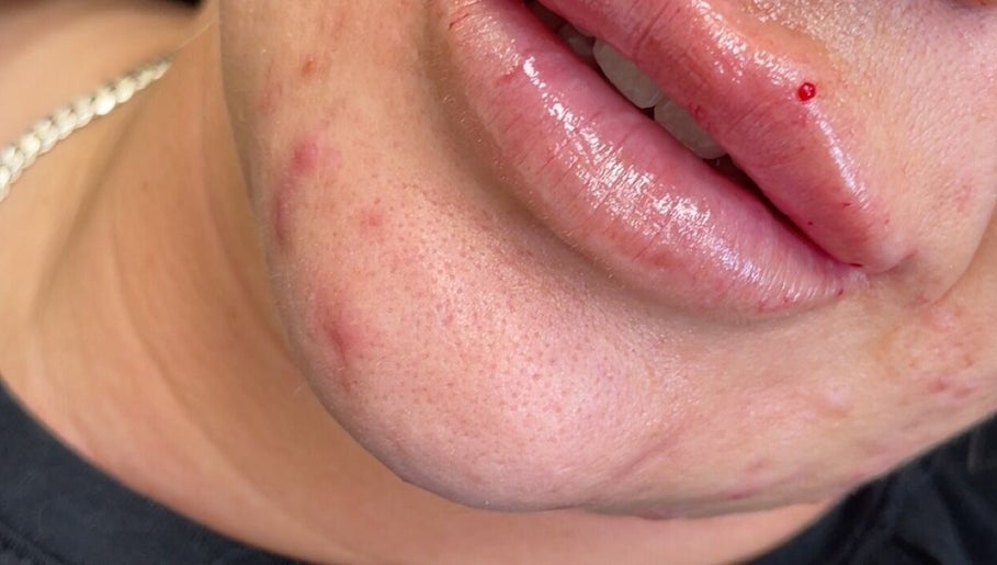 Close-up of lips and skin treatment at CMA GLAM&TAN, Chadderton, England, GB.