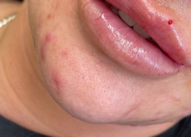 Close-up of lips and skin treatment at CMA GLAM&TAN, Chadderton, England, GB.