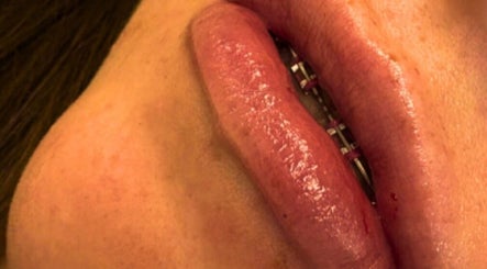 Lush lip enhancement at CMA GLAM&TAN, Chadderton, England, GB showcasing expert beauty treatment.