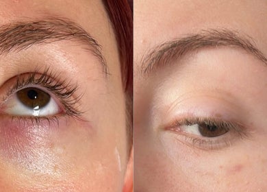 Before and after eyebrow treatment at TweaksByMia, Colchester, England, GB.