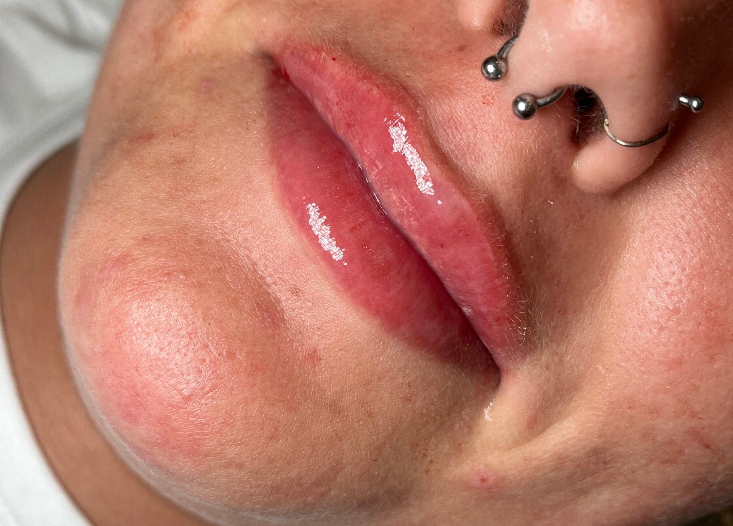 Close-up of glossy lips at TweaksByMia, Colchester, England, GB, showcasing beauty enhancement.