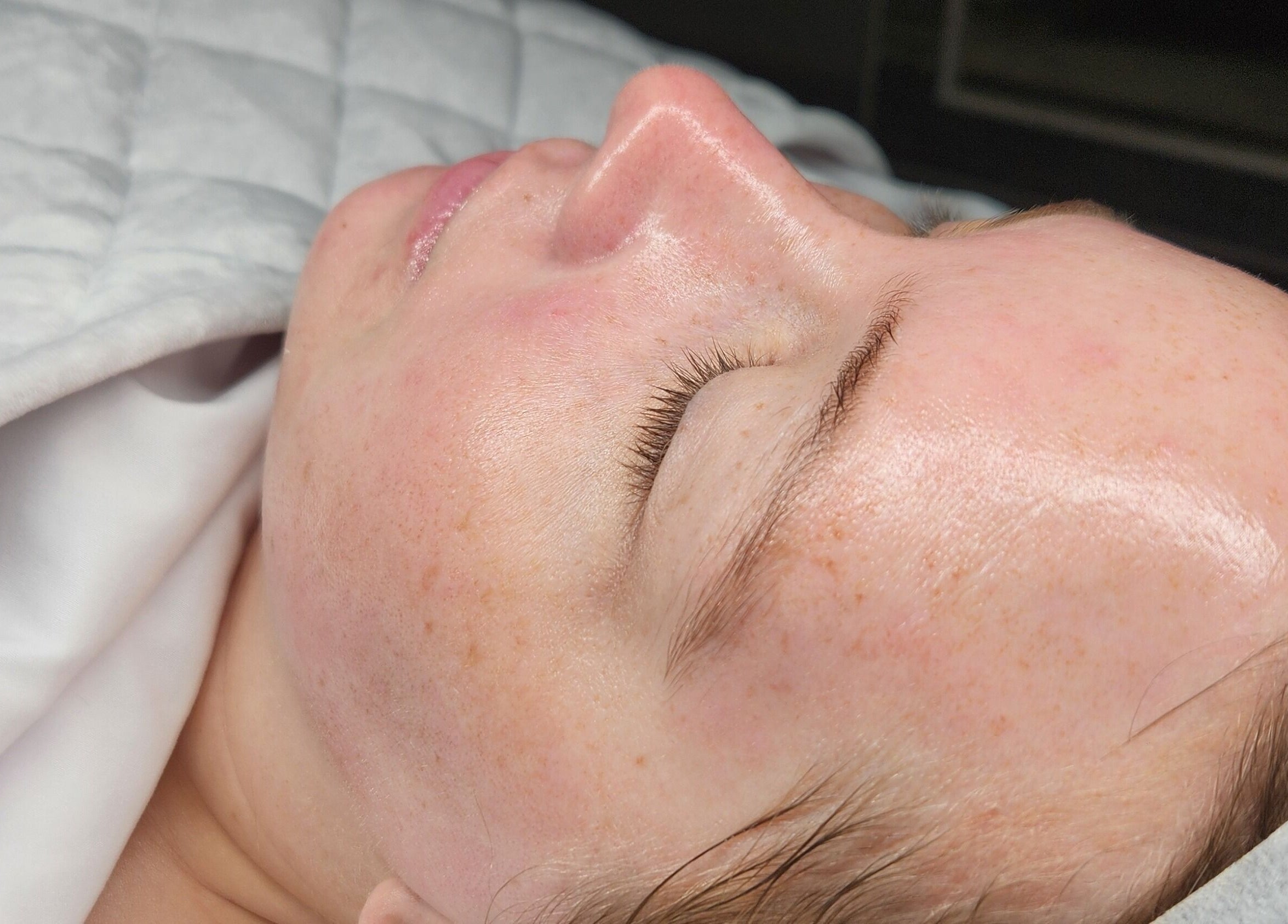 Glowing skin treatment at Enlightened Esthetics, Woodstock, Georgia, US. Relaxed client with smooth complexion.