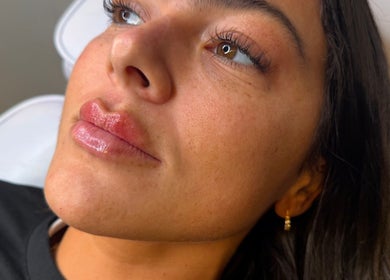 Close-up of a client's radiant skin after treatment at LJT Aesthetics, Herne Bay, England, GB.