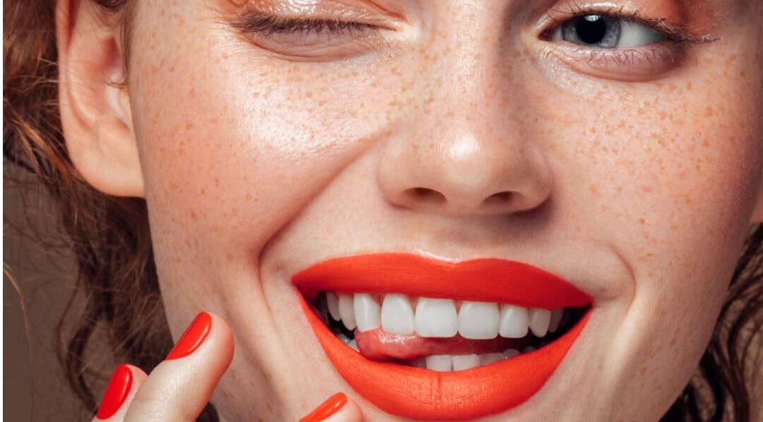 Modelo con labios rojos y uñas combinadas en Clínica Florencia, Concepción, Bío Bío, CL.