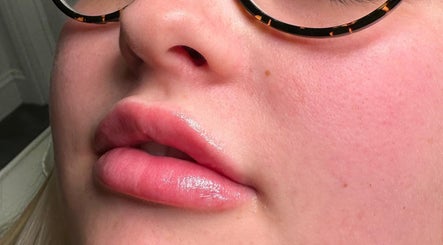 Amais Aesthetics image 2