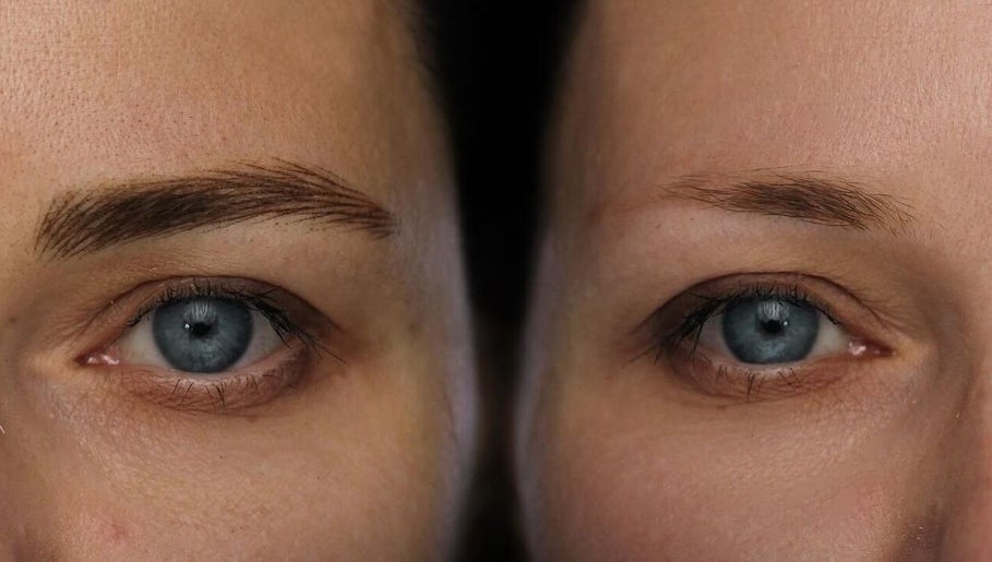 Brow transformation at Antidote Beauty Space in Sydney, New South Wales, AU. Before and after eyebrow styling.