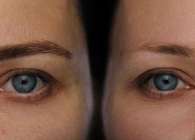Brow transformation at Antidote Beauty Space in Sydney, New South Wales, AU. Before and after eyebrow styling.