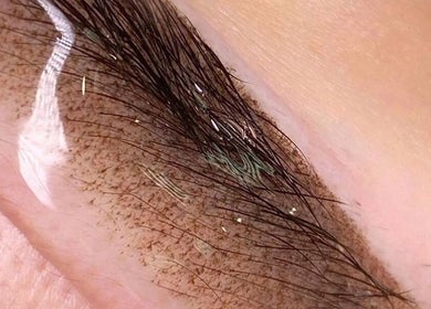 Close-up of eyebrow microblading at Antidote Beauty Space - Caringbah, Caringbah, New South Wales, AU.