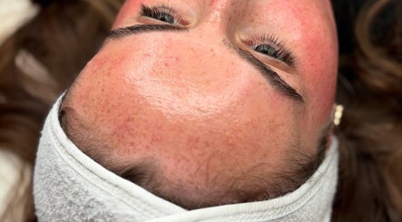 Close-up of a facial treatment at Megan Bond Aesthetics, Astley Cross, England, GB, showing refined skin texture.
